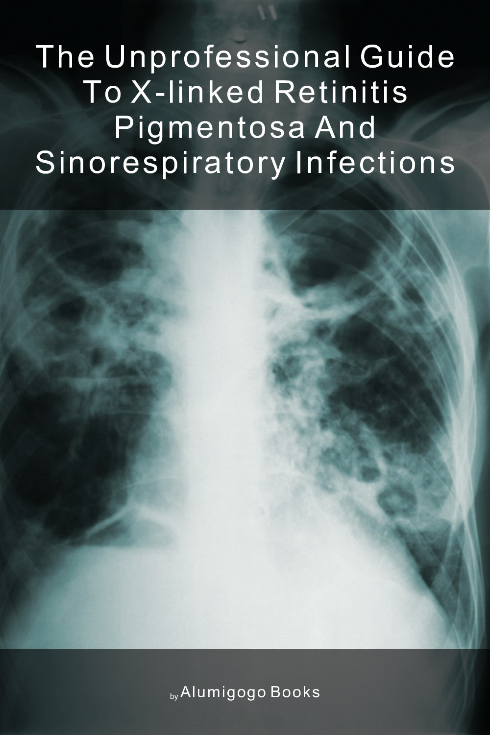 Cover of The Unprofessional Guide to X-linked retinitis pigmentosa and sinorespiratory infections