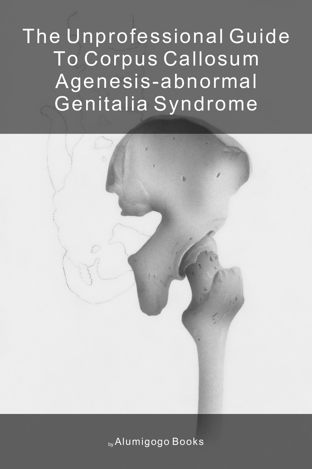 Cover of The Unprofessional Guide to corpus callosum agenesis-abnormal genitalia syndrome