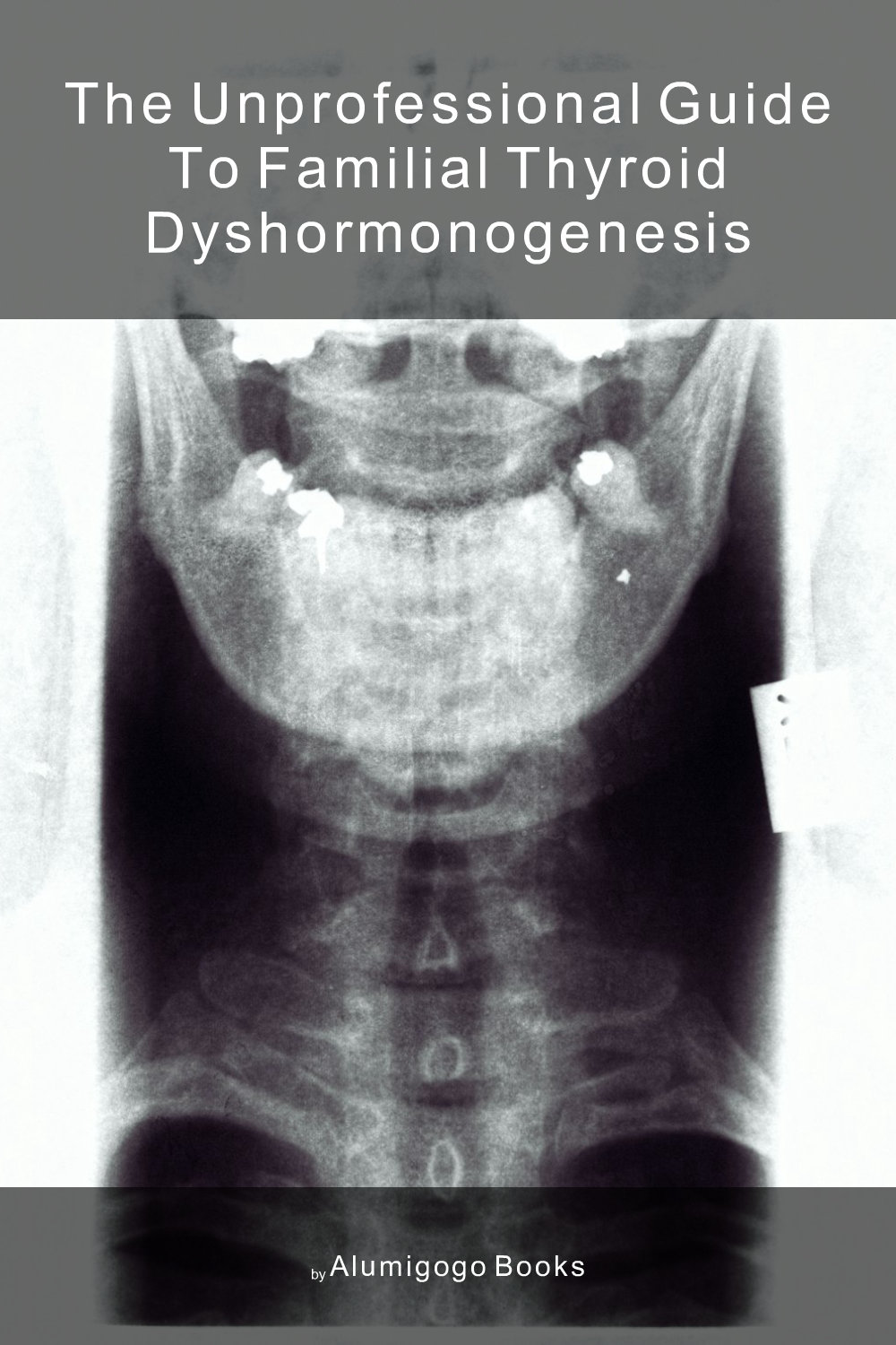 Cover of The Unprofessional Guide to familial thyroid dyshormonogenesis