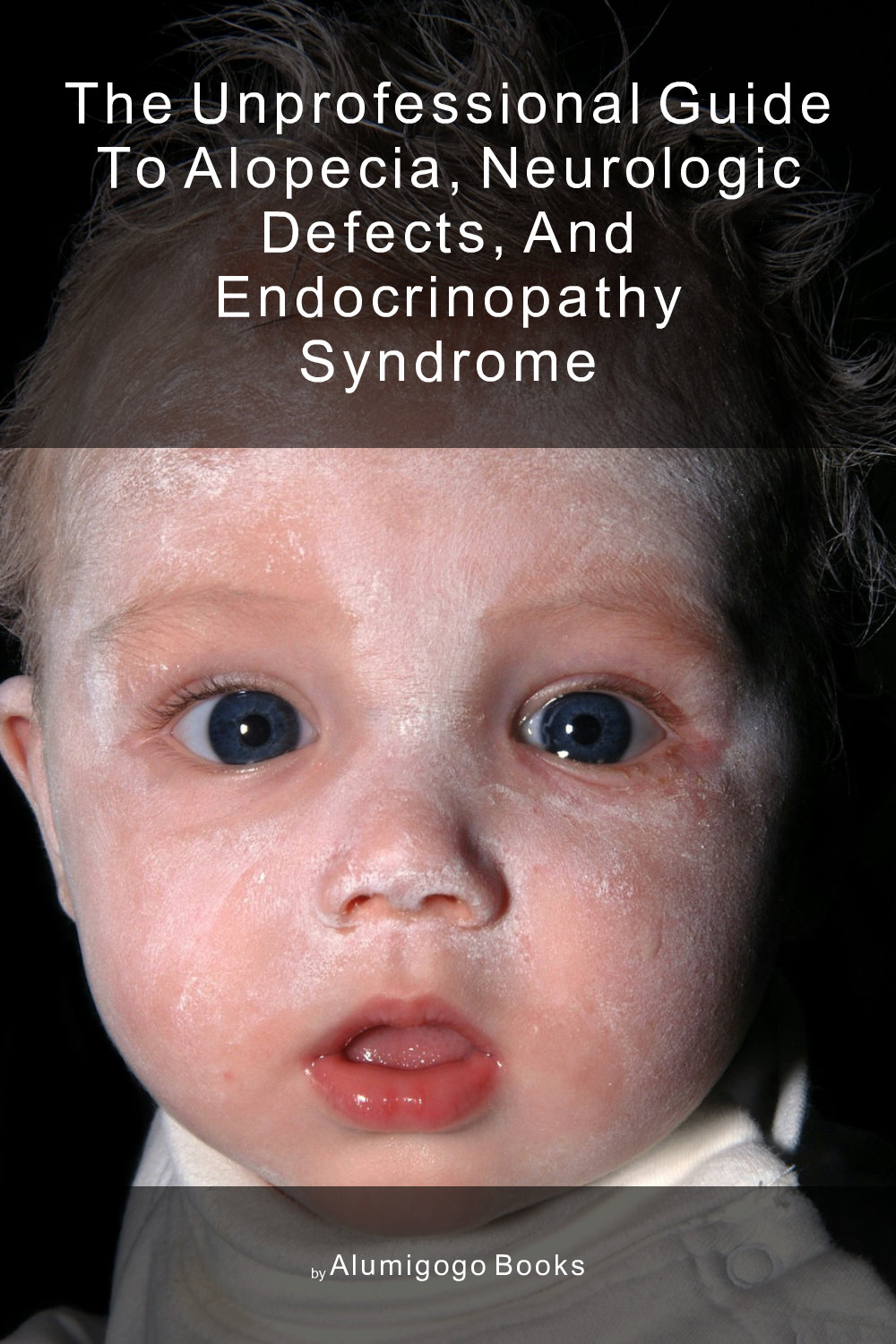 Cover of The Unprofessional Guide to alopecia, neurologic defects, and endocrinopathy syndrome
