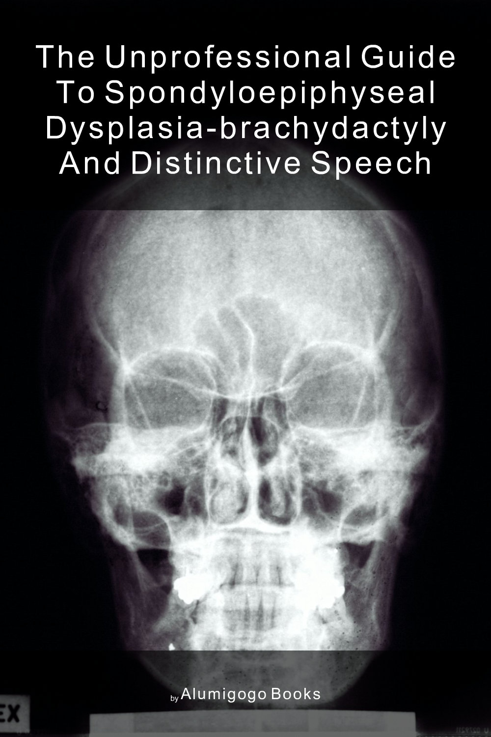 Cover of The Unprofessional Guide to spondyloepiphyseal dysplasia-brachydactyly and distinctive speech